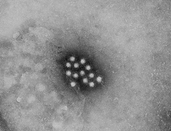 Хепатит, вирус, вируси, оцелеят, месец, стая, температура