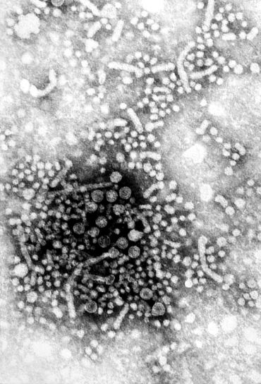 l'hépatite, le virus, les virions, savoir, dane, particules, contient, génome, adn