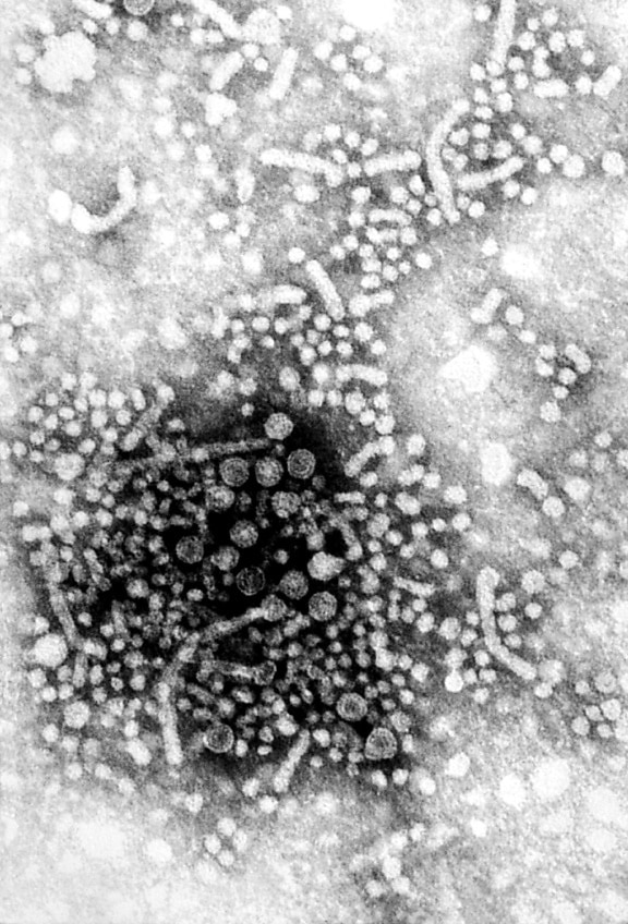 la hepatitis, virus, viriones, saber, danés, partículas, contiene, genoma, el ADN
