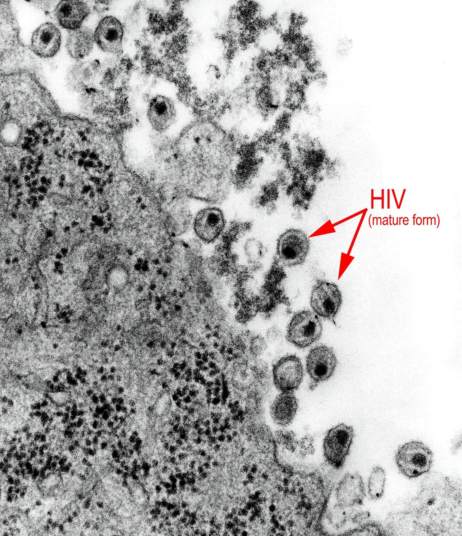 5-virus-lidsk-imunodeficience-hiv-bezplatn-obr-zky