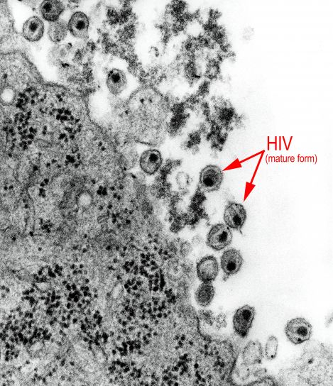 human immundefekt virus, retrovirus