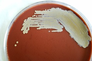 Free Picture: Burkholderia Thailandensis, Bacteria, Sheep, Blood Agar ...