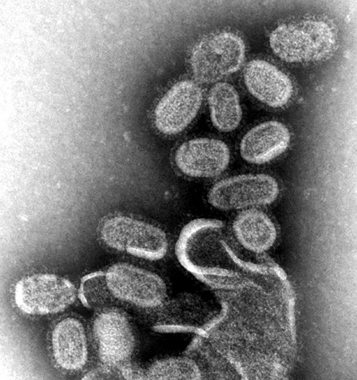 1918 influensa, virions, samlet, supernatants, 1918 infeksjon, madin, darby, hjørnetann, nyre, celler, cultu