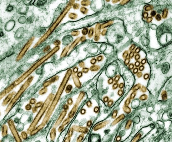 colorized, electron micrograph, avian, influenza, h5n1, viruses, cells