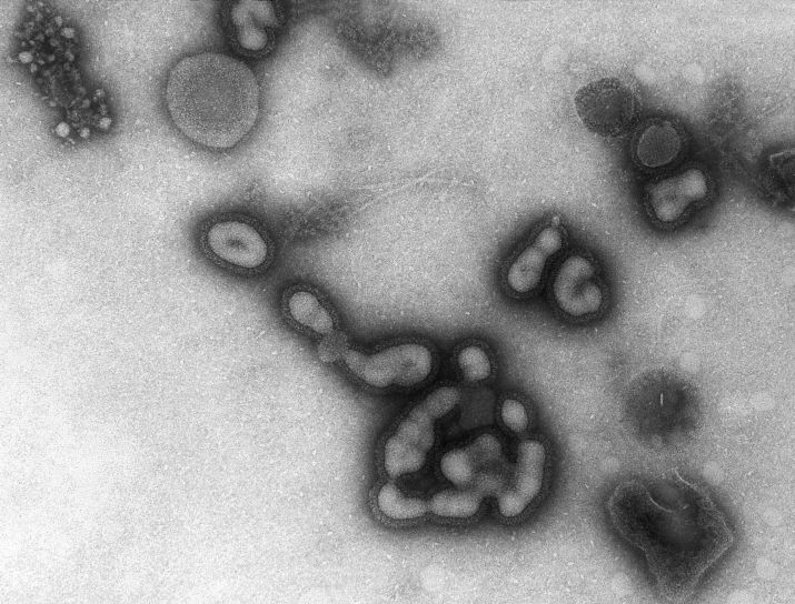 Russisk, influensa, H1N1, Sovjetunionen, belastning, virions, cells