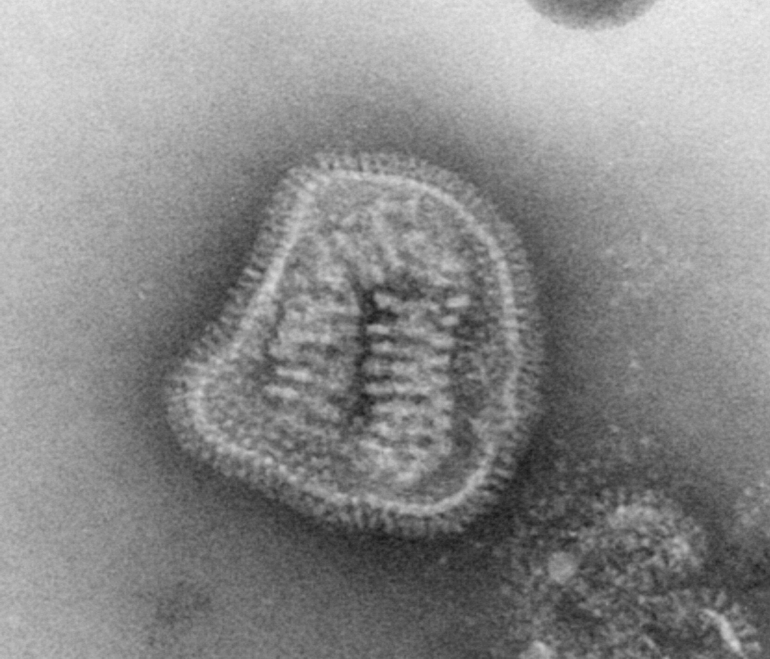 Вирус гриппа под. Вирус гриппа микрофотография. Вирус гриппа электронная микроскопия. Электронная микрофотография вируса гриппа а. Вирус микроскопия коронавирус.