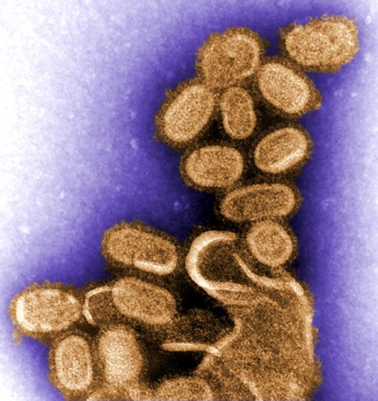negative, transmission, electron micrograph, shows, recreated, 1918, influenza, virions
