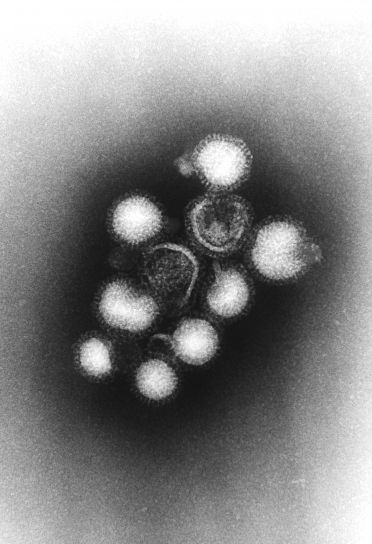 否定的、伝送、電子顕微鏡写真、小さい、インフルエンザ、ウイルス粒子のグループ化