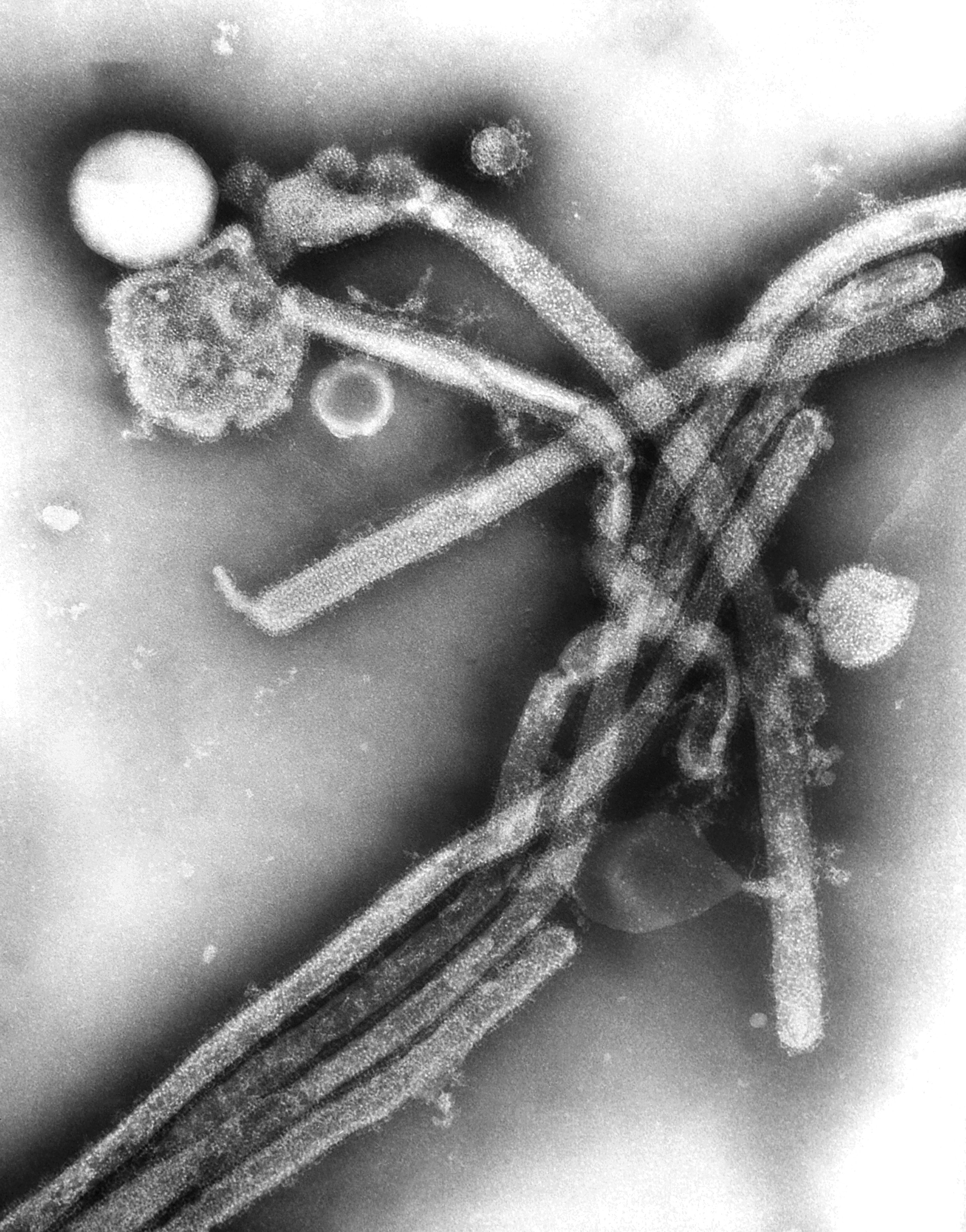 Фотографию вируса и названия. Чума вирус под микроскопом. Вирус чумы плотоядных под световым микроскопом. CWD вирус под микроскопом. Вирус бубонной чумы под микроскопом.