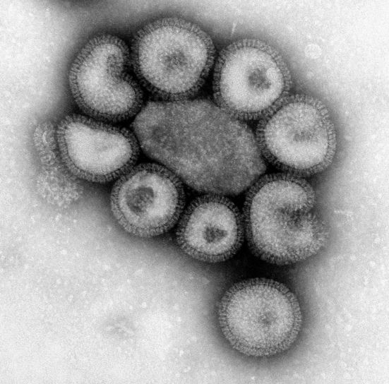 インフルエンザ、伝染性、呼吸器の病気、インフルエンザ ウイルス