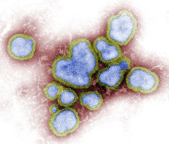 digitally, colorized, negative, transmission, electron, micograph, influenza, virions