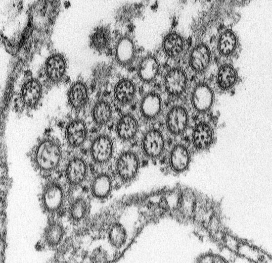 magnified, transmission, electron micrograph, numbers, virions, novel, flu, H1N1, isolate