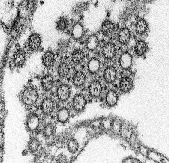拡大すると、伝送、電子顕微鏡写真、数値、ウイルス粒子、小説、インフルエンザ、H1N1 を分離