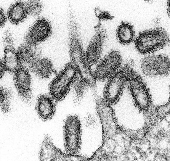อัลตร้า บาง ชิ้นงาน ศึกษาลักษณะชนิด morphologic คุณสมบัติ 1918 ไข้หวัด viru