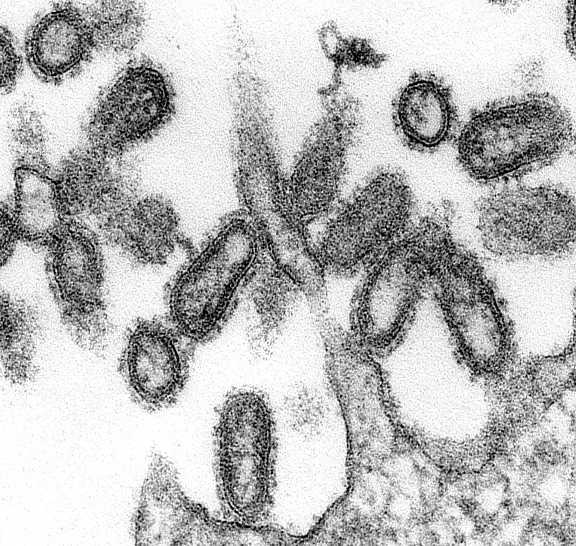 ultra mince, spécimen, ultrastructural, morphologique, caractéristiques, 1918, la grippe, viru