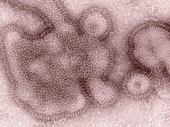 超微结构, 细节, h3n2, 流感, 病毒