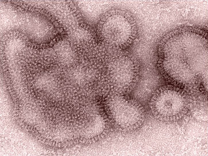 ultraestructurales, detalles, H3N2, influenza, los viriones