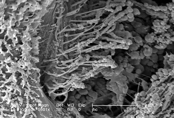 exoskeletal ผิว ยุงก้นปล่อง ยุง gambiae, spiracle ฟิลด์ mesothoracic