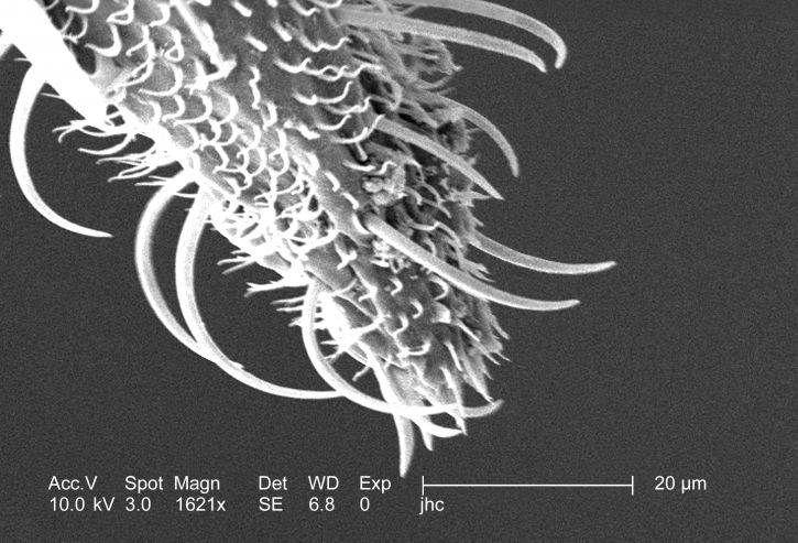 lectron, micrograph, ornately, festooned, tip, anopheles gambiae, mosquitos proboscis