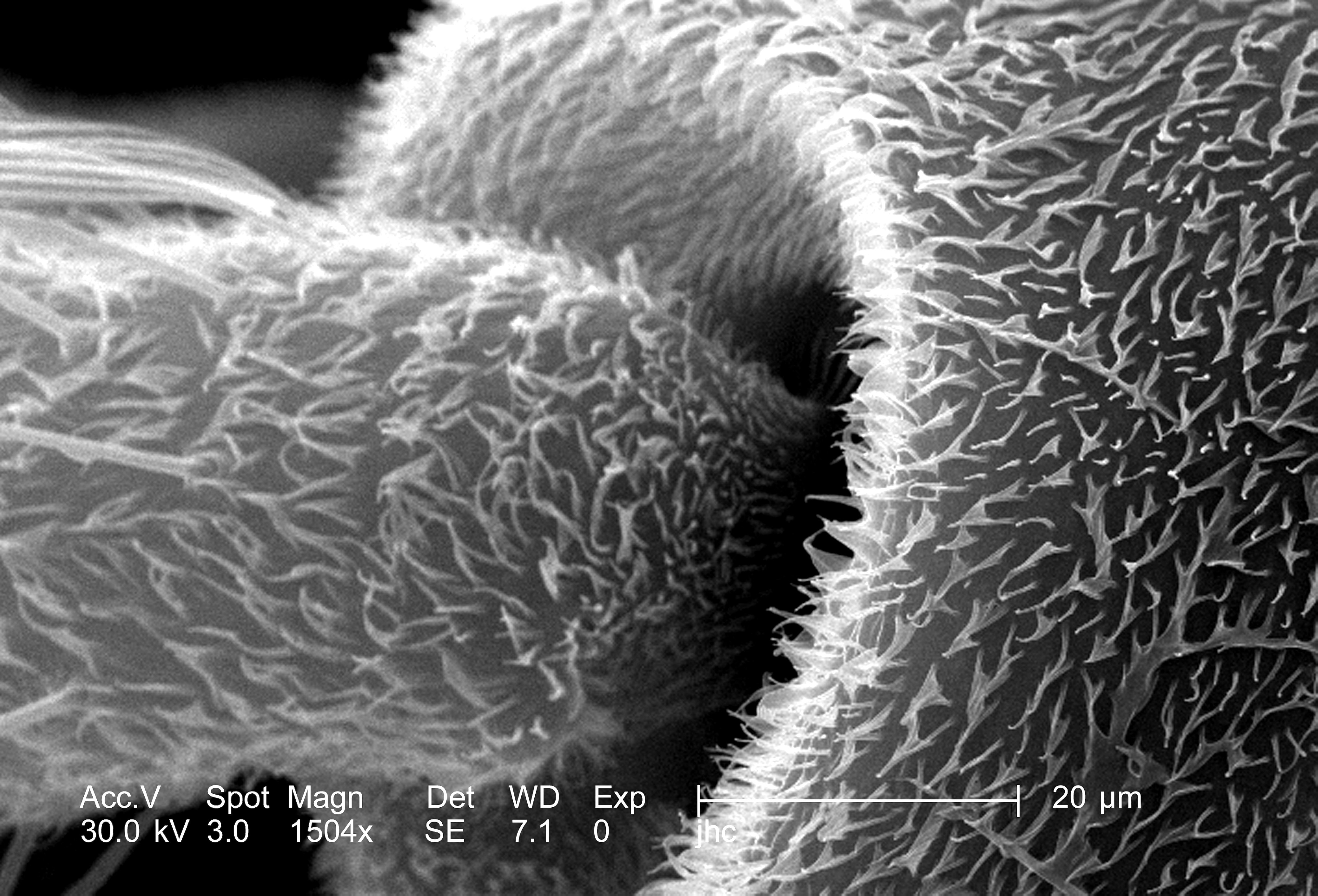 Обида микроскоп. 1 Микрон под микроскопом. Микромир под электронным микроскопом. Электронный микроскоп снимки. Ворс под микроскопом.