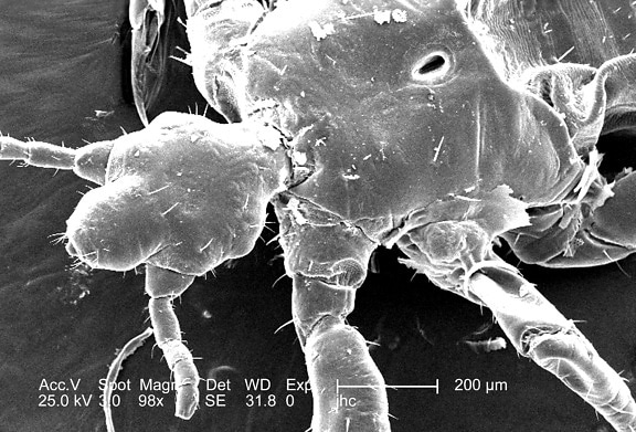 หลัง หัว ทรวงอก เพศชาย ร่างกาย louse, pediculus humanus corporis