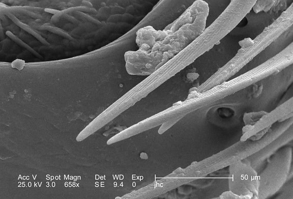 magnification, 658x, morphologic, exoskeletal, details, female, velvet, ant