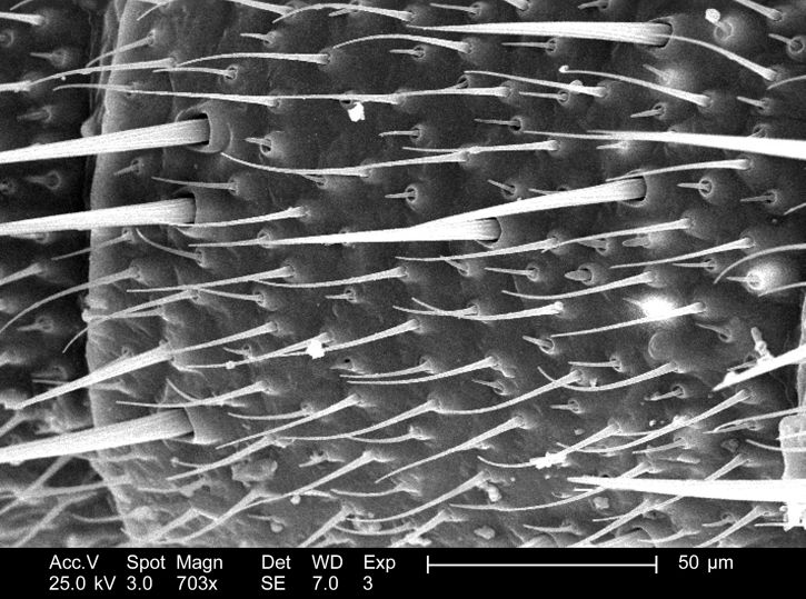 magnified, 703x, ultrastructural, details, exterior, segmented, length