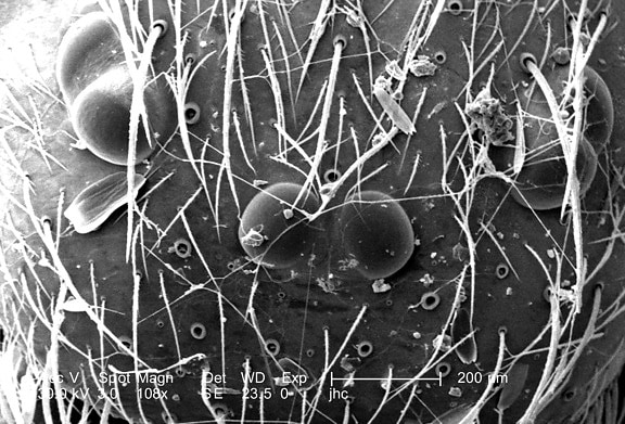 micrograph, trên lưng, cephalothorax, kết hợp, khu vực đầu, ngực,