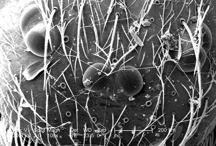 cephalothorax, micrograph, selkä, pää, rinta-, alueiden, yhdistelmä