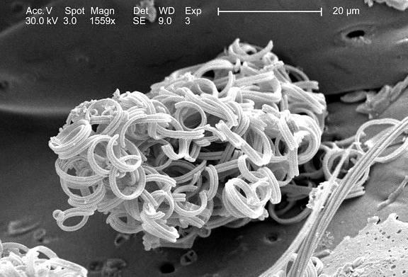 puing-puing mikroskopis, exoskeletal, permukaan, teridentifikasi, serangga