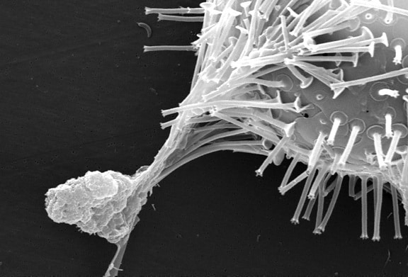 mikroskopické, pin, polštář, teathered, okolí, biofilm, mnoho, bakterie
