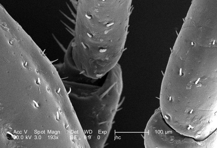 scanning, electron micrograph, male, dermacentor