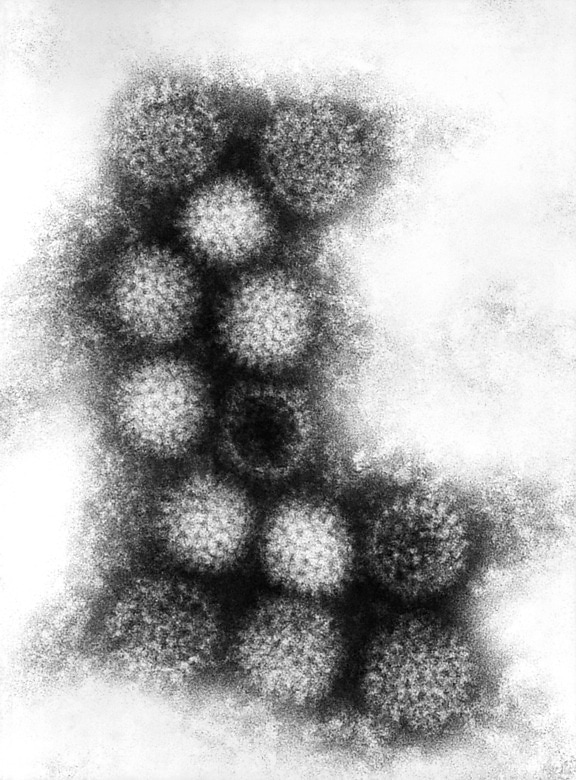 irituia, στέλεχος, changuinola, ιό, μέλος, γένος, orbiviruses
