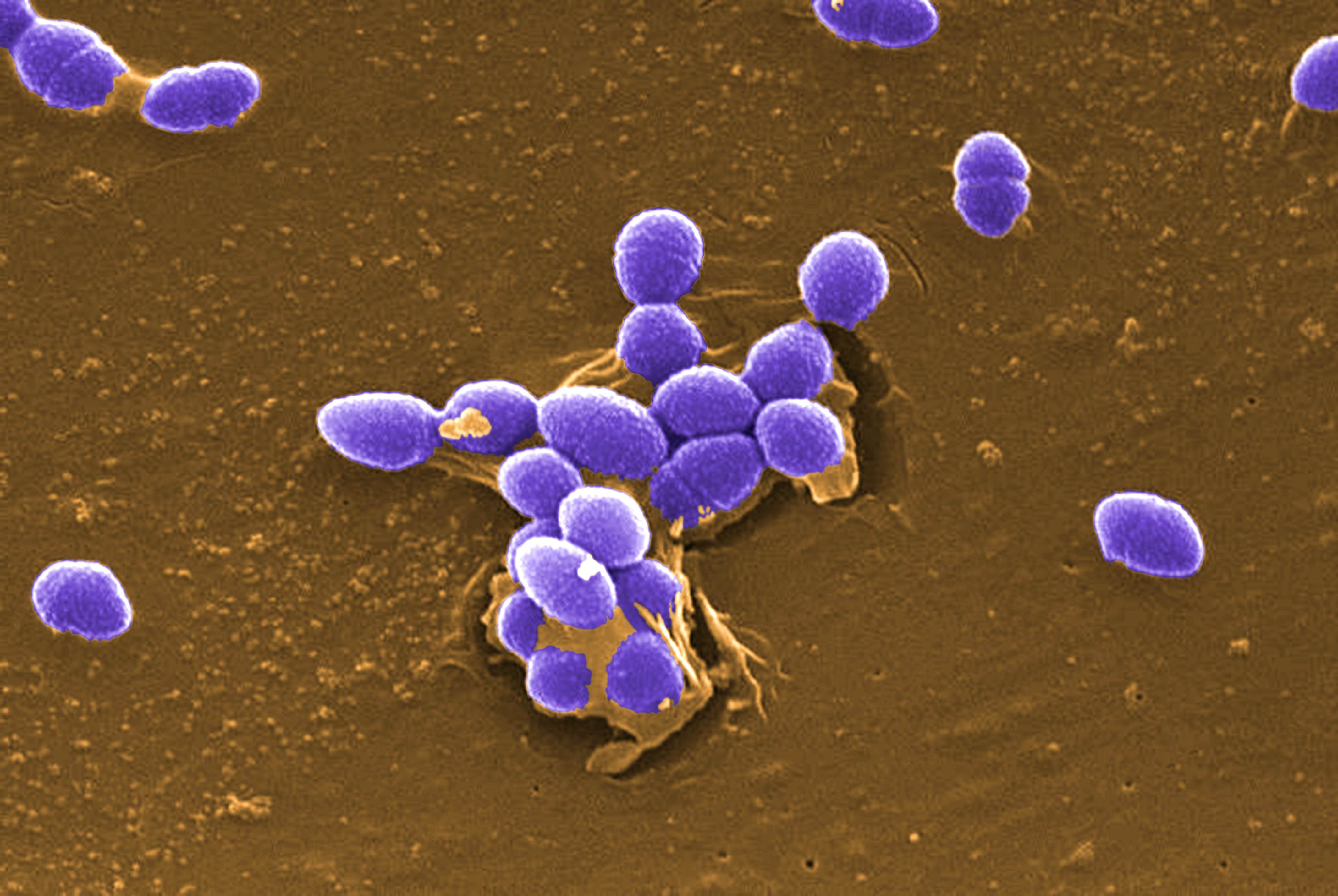 Free picture: large, numbers, gram, positive, enterococcus faecalis