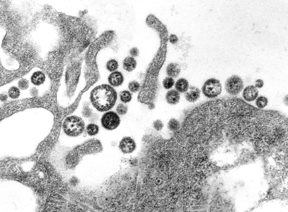 ラッサ、ウイルス、ウイルス粒子は、隣接するセル、破片、ウイルス、メンバー、ウイルス、家族、arenaviridae