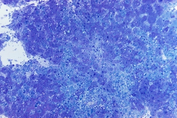 photomicrograph, hepatiitti, lassa, virus, toluidiinin, sininen, azure, tahra, suurennettu, 315 x
