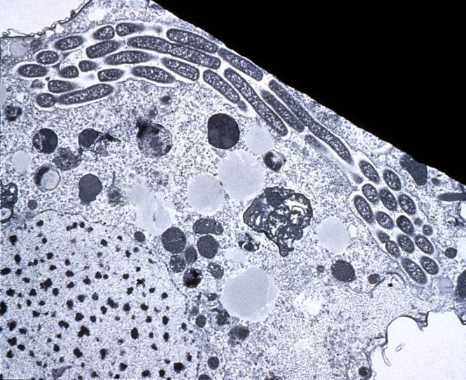 tetrahymena, pyriformis, 원생 동물, 크로스 섹션, 체인, 세포내, 레지오 넬 라 pneumophila 박테리아