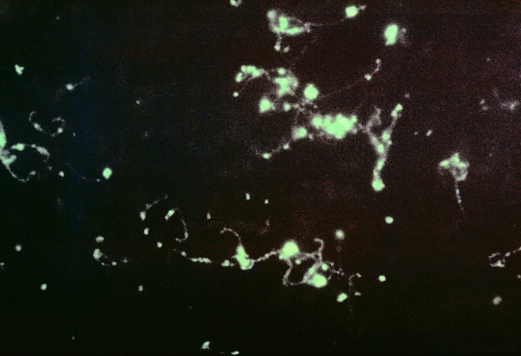 photomicrograph fluorescerande antikropp, fläcken, leptospira, bakterier, levern, intryck, smear