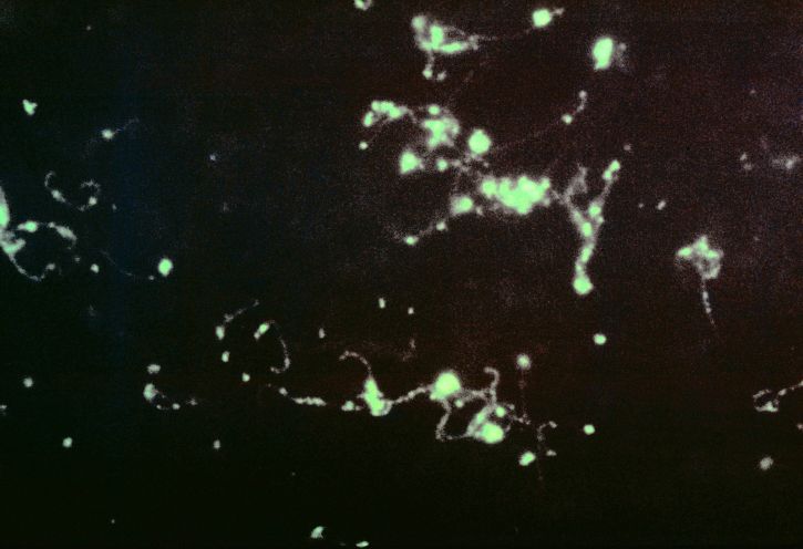 photomicrograph ฟลูออเรสเซนต์ แอนติบอดี สีย้อม leptospira แบคทีเรีย ตับ ประทับใจ มดลูก