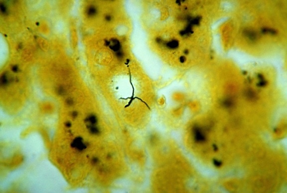 photomicrograph, leveren, væv, afslørende, tilstedeværelse, leptospira, bakterier