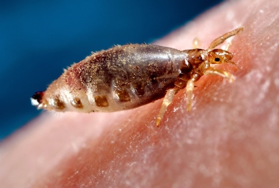 body, lice, parasitic, insects, live, body, clothing, bedding, infested, hu