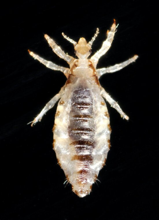 body, lice, infestation, common, worldwide, affects, people, races