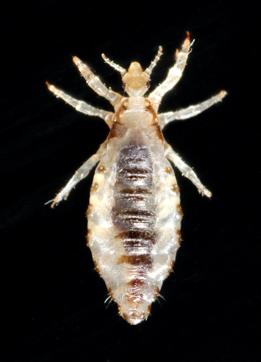 Free Picture Body Lice Infestation Common Worldwide Affects