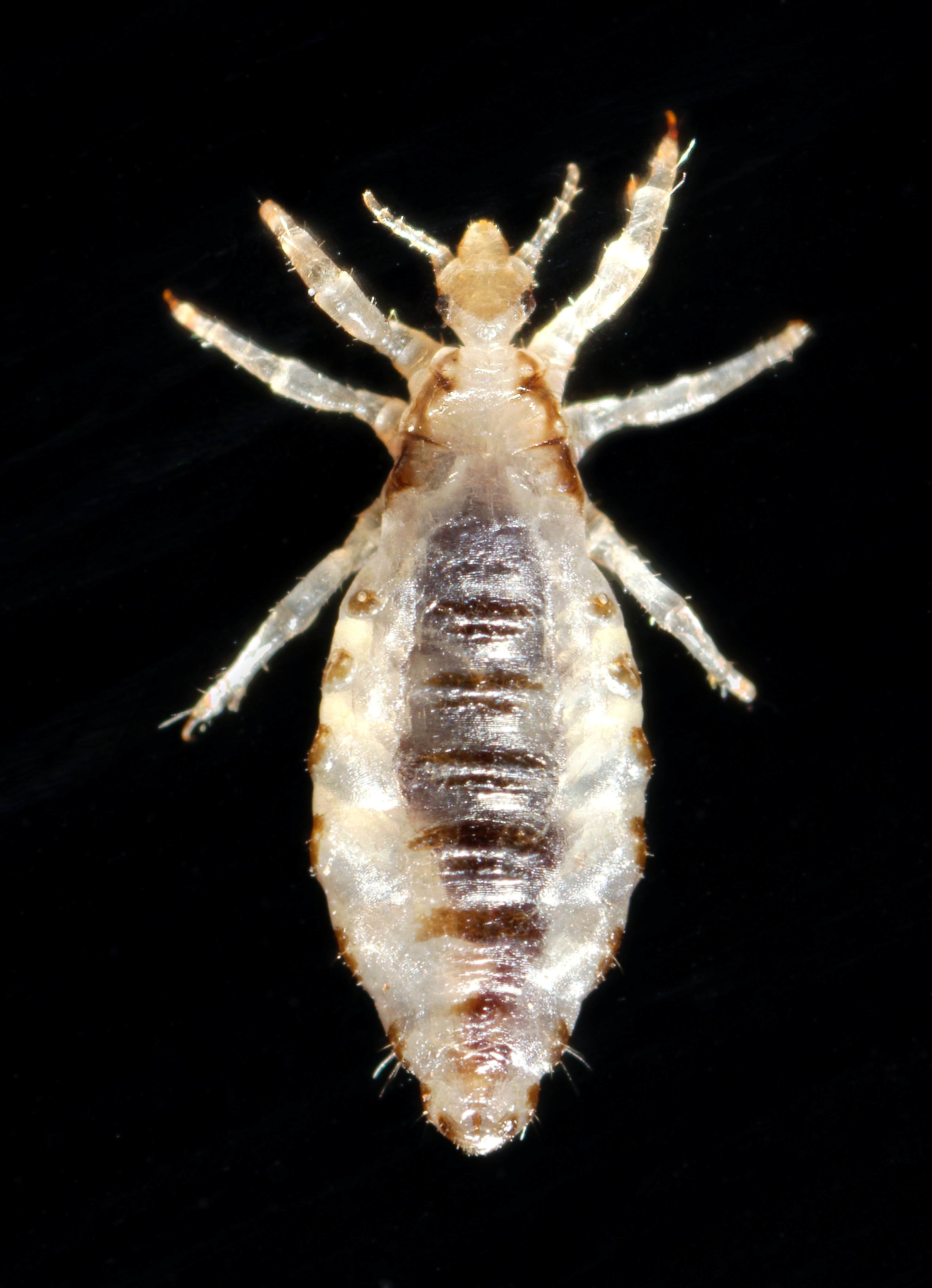 Free picture: body, lice, infestation, common, worldwide, affects