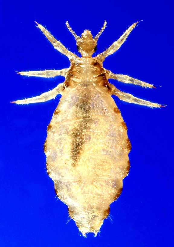 dorsale, di sesso femminile, corpo, pidocchio, Pediculus humanus corporis