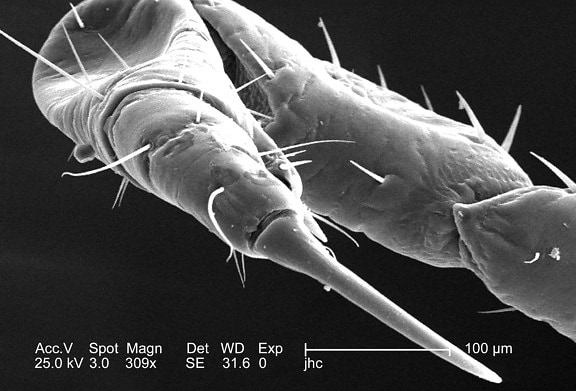 dorsal, flexed, foreleg, female, body, louse, pediculus humanus corporis