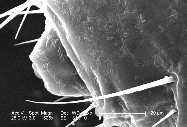 ขยาย หลัง ปาก ภูมิภาค เพศชาย louse, pediculus humanus corporis