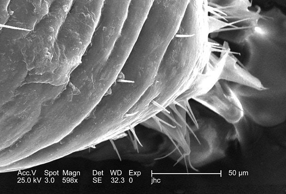 ingrandita, 598x, microscopio elettronico, chitinoso, exoskeletal, di superficie, di sesso maschile, pidocchio