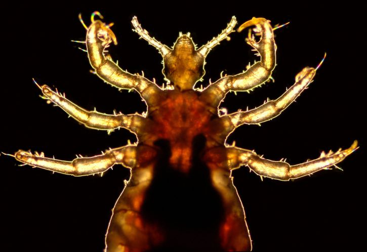 magnified, male, body, louse, pediculus humanus corporis, focusing, insects, cephalic, thoracic, regions