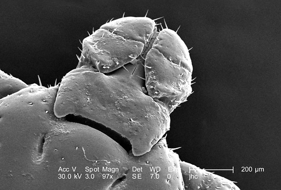 scanning, electron micrograph, dorsal, unidentified, male, dermacentor